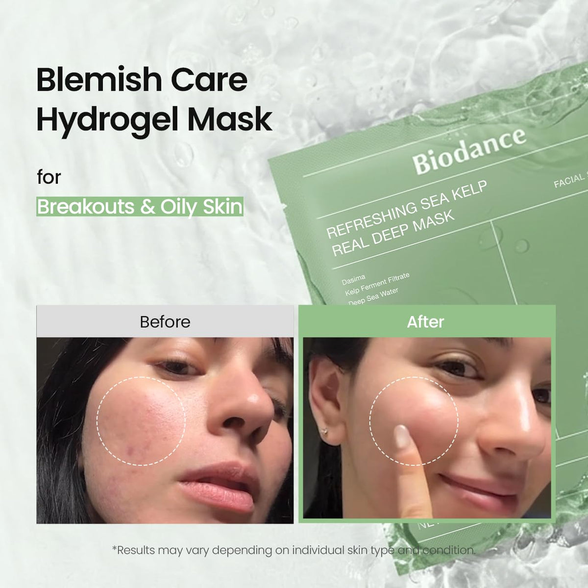 BIODANCE Bio-Collagen Real Deep Mask, Hydrating Overnight Hydrogel Face Mask, Pore Minimizing, Elasticity, Plumping, Travel Essentials &amp; Self Care Gifts for Women, Korean Skin Care | 1.19oz(34g) x 4ea