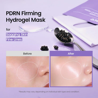 BIODANCE Bio-Collagen Real Deep Mask, Hydrating Overnight Hydrogel Face Mask, Pore Minimizing, Elasticity, Plumping, Travel Essentials &amp; Self Care Gifts for Women, Korean Skin Care | 1.19oz(34g) x 4ea